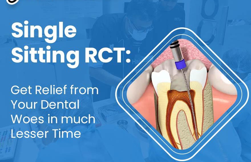 Painless Single Sitting RCT