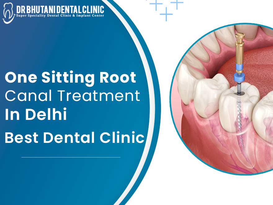 Root Canal Treatment